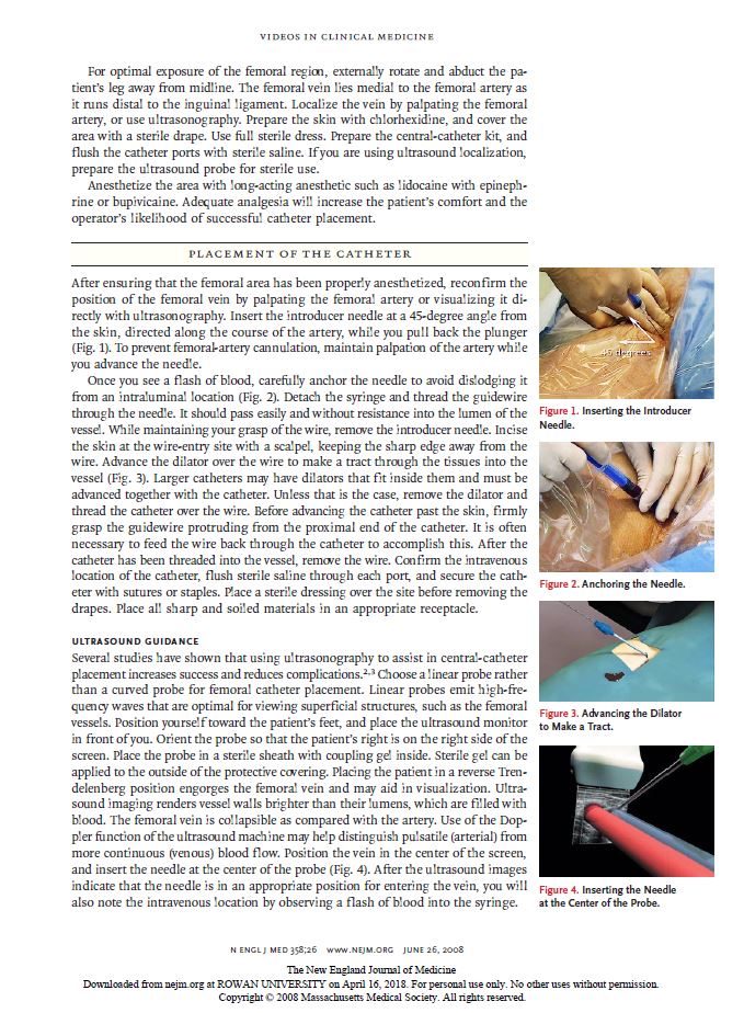 Femoral2