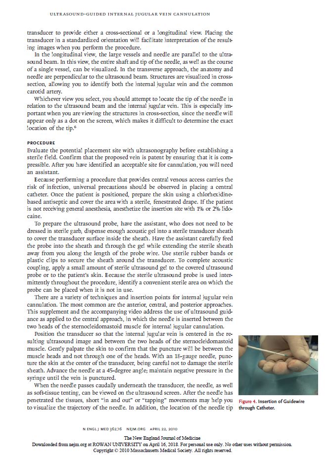 InternalJugular3