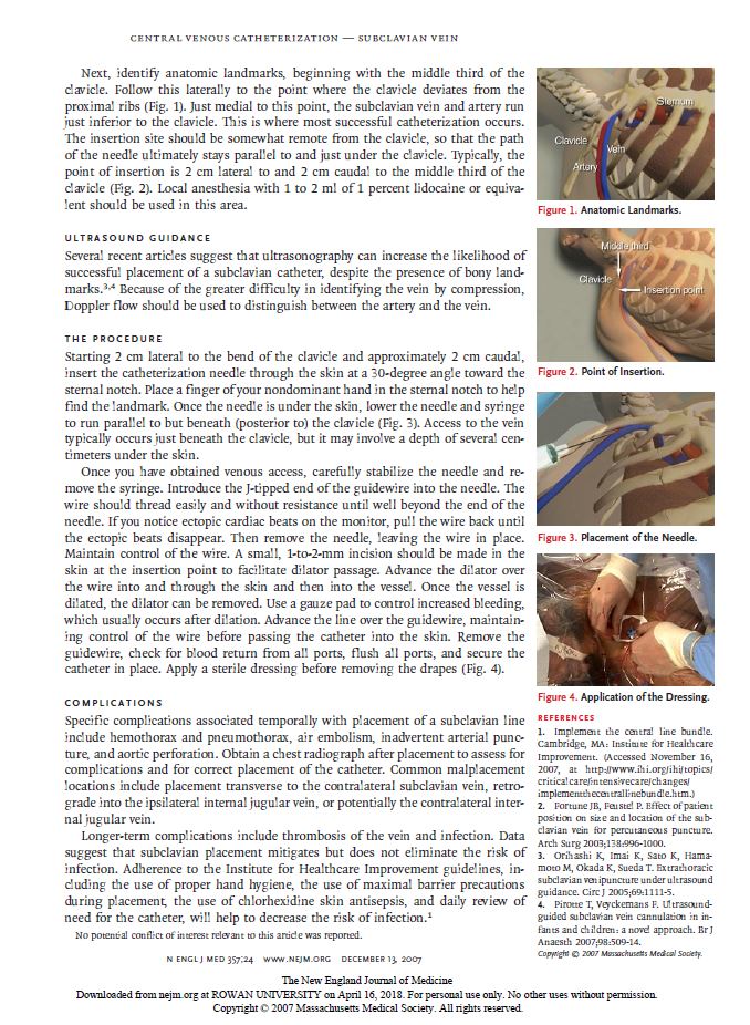 Subclavian2